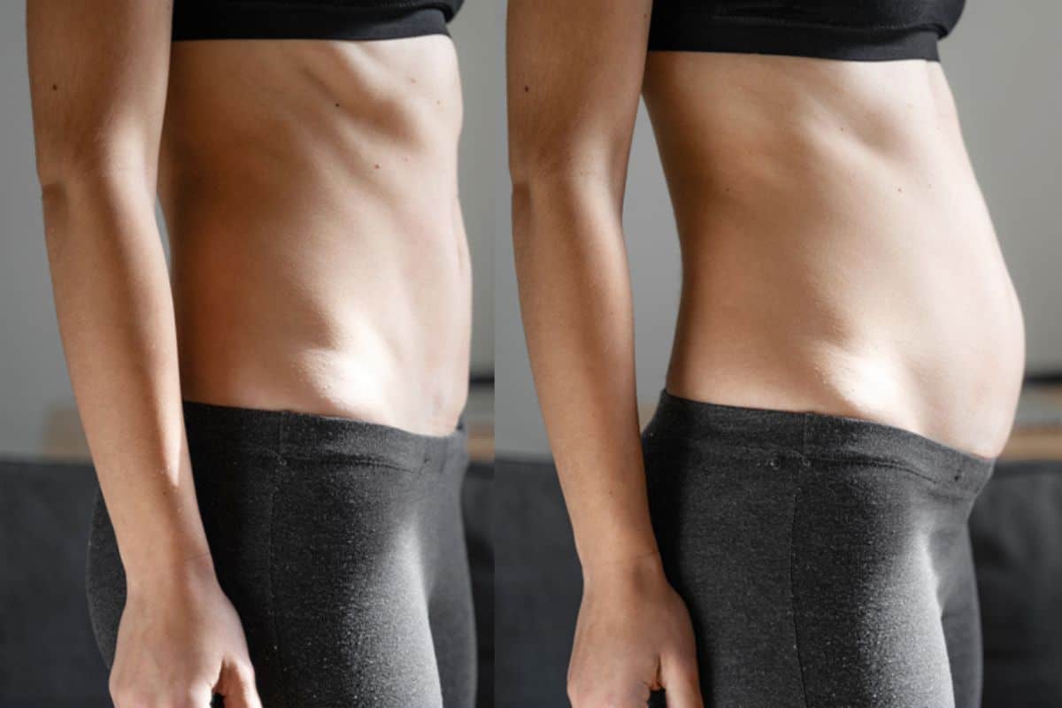 How long does diastasis recti take to improve Horley?